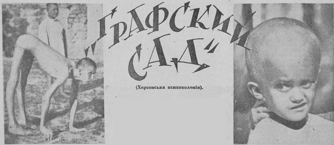 На фото: ліворуч — «людина-собака» (в чоловіка через хворобу внутрішніх залоз витягнулося тіло), праворуч — семирічна дівчинка з ненормальним розвитком черепної коробки