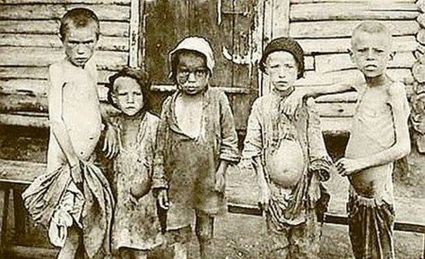 Опухлі від голоду українські діти під час Голодомору 1931-1933 років