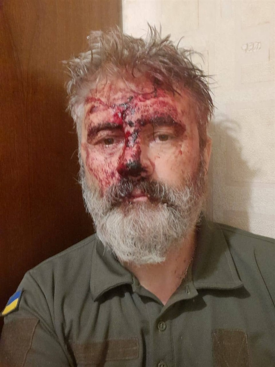 Климент після побиття